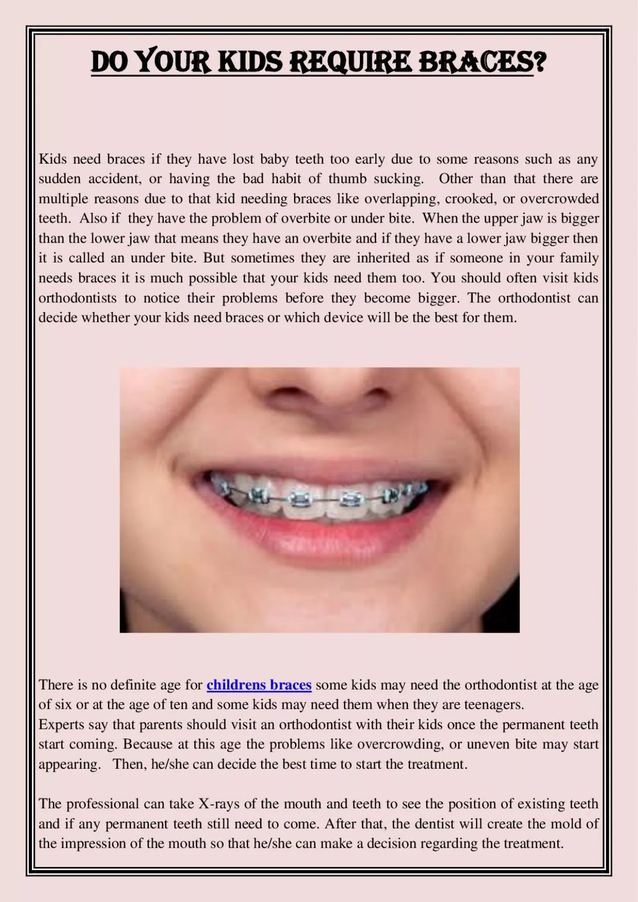 PDF-Do your kids require braces?