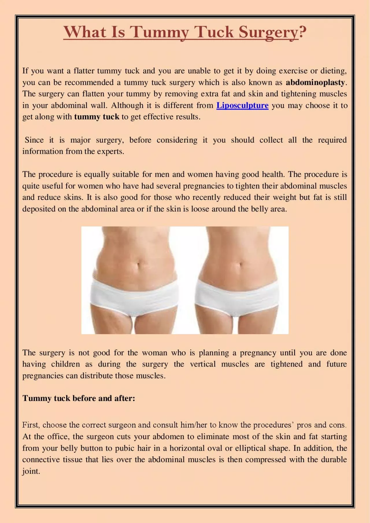 PDF-What Is Tummy Tuck Surgery?