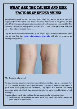 What are the causes and risk factors of spider veins?