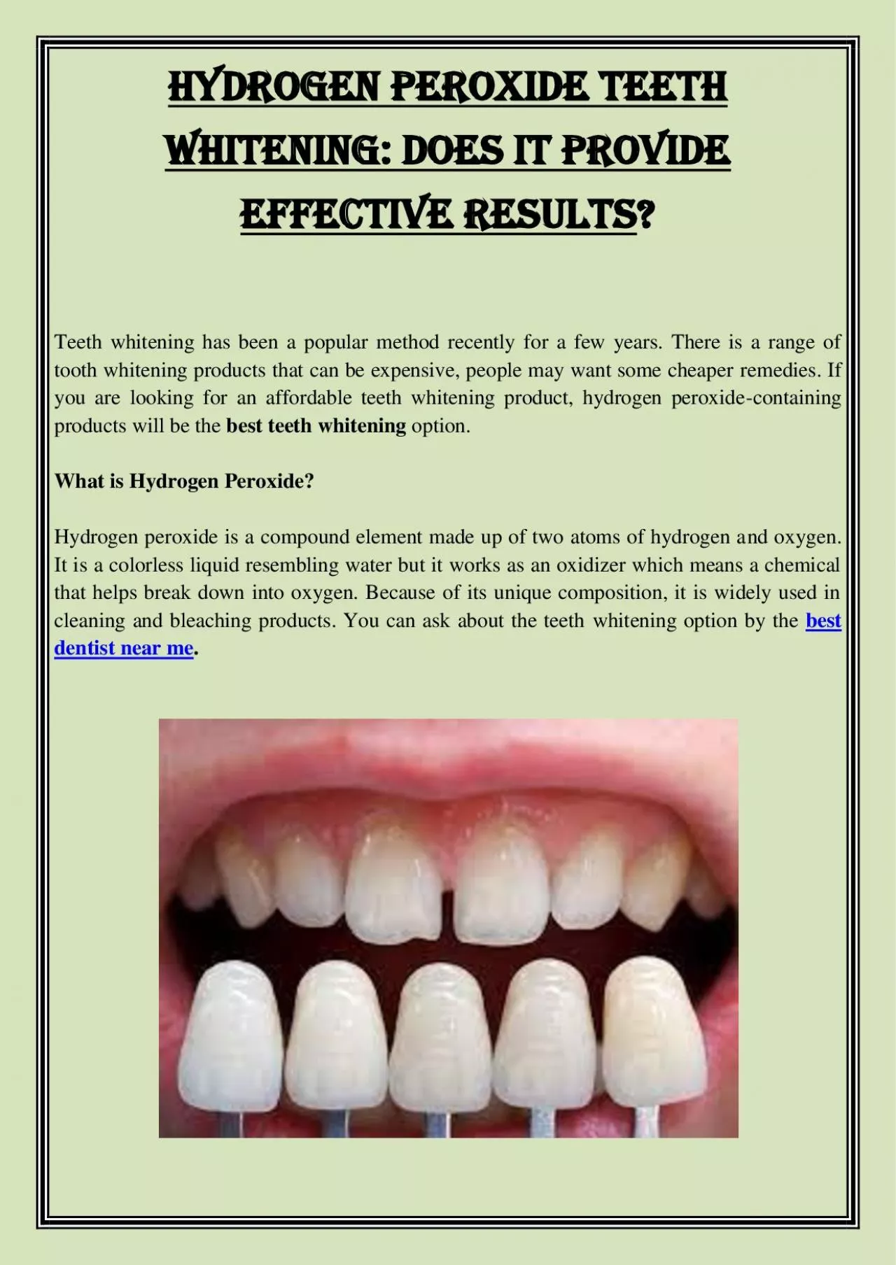 PDF-Hydrogen Peroxide Teeth Whitening: Does It Provide Effective Results?