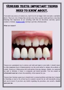 Veneers Teeth: Important Things Need To Know About.