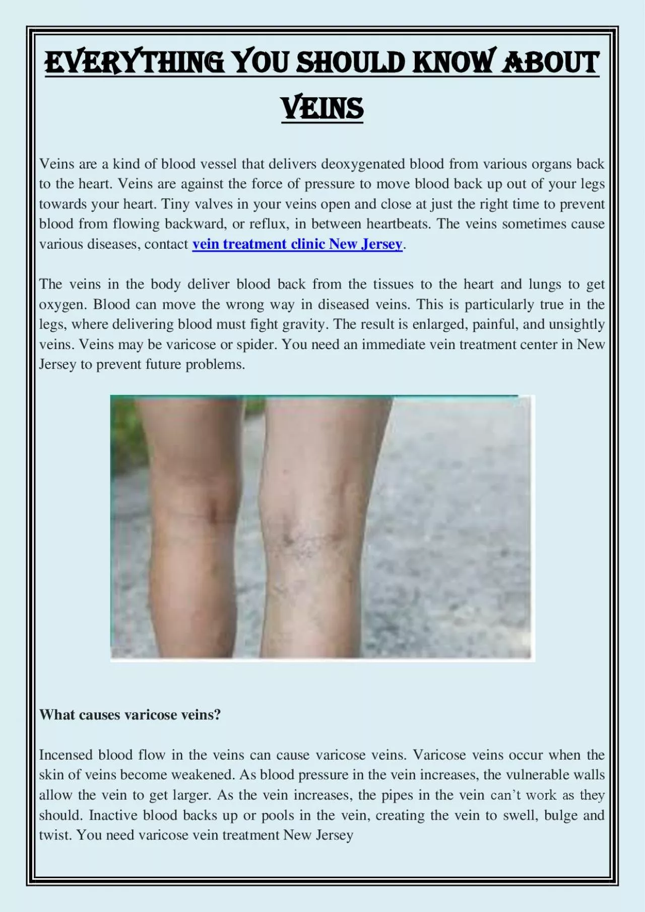 PDF-Everything you should know about veins