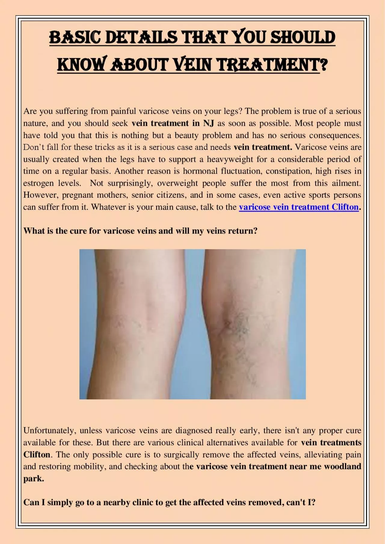 PDF-Basic Details That You Should Know About Vein Treatment?