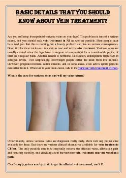 Basic Details That You Should Know About Vein Treatment?