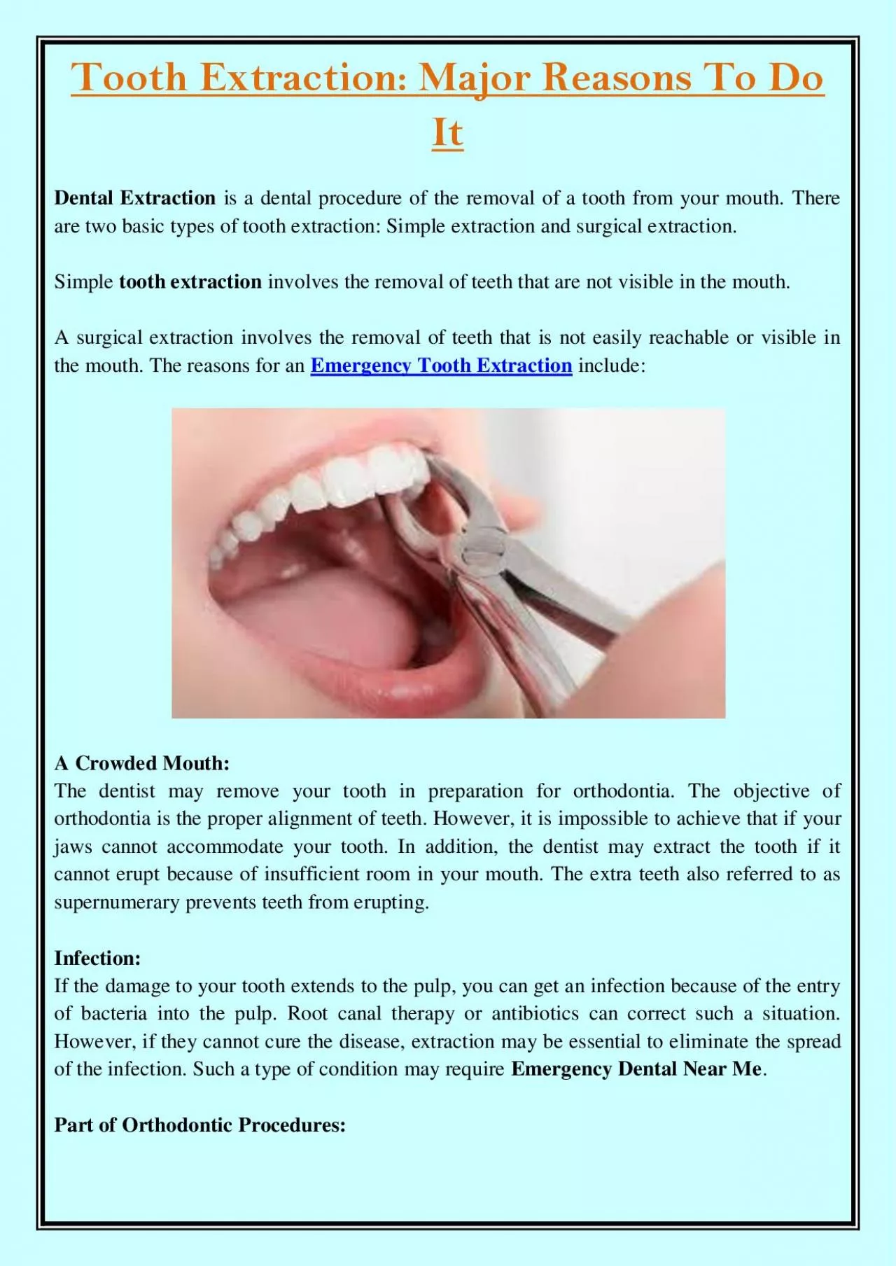 PDF-Tooth Extraction: Major Reasons To Do It