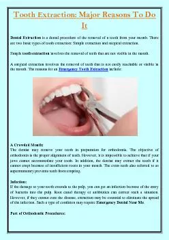 Tooth Extraction: Major Reasons To Do It