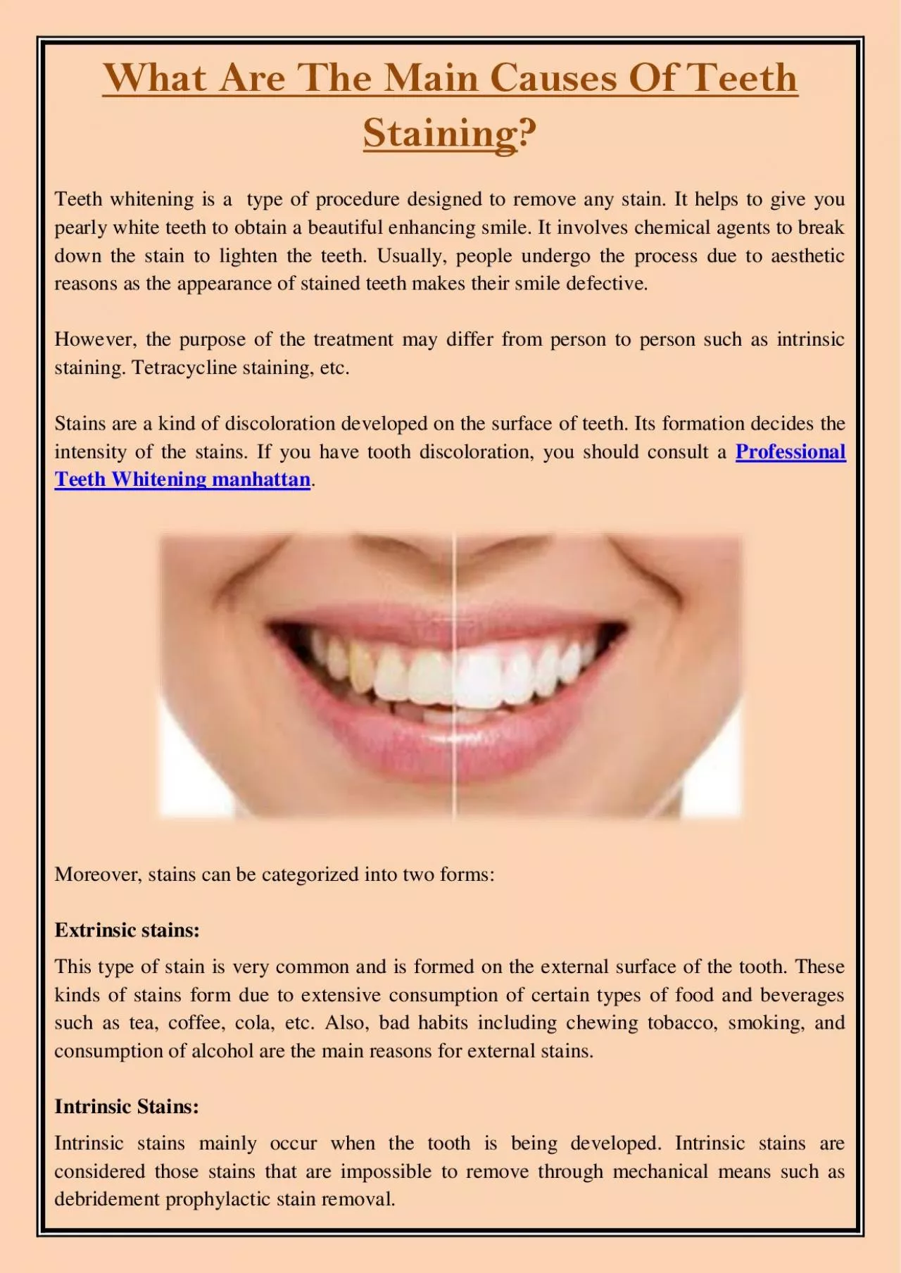 PDF-What Are The Main Causes Of Teeth Staining?