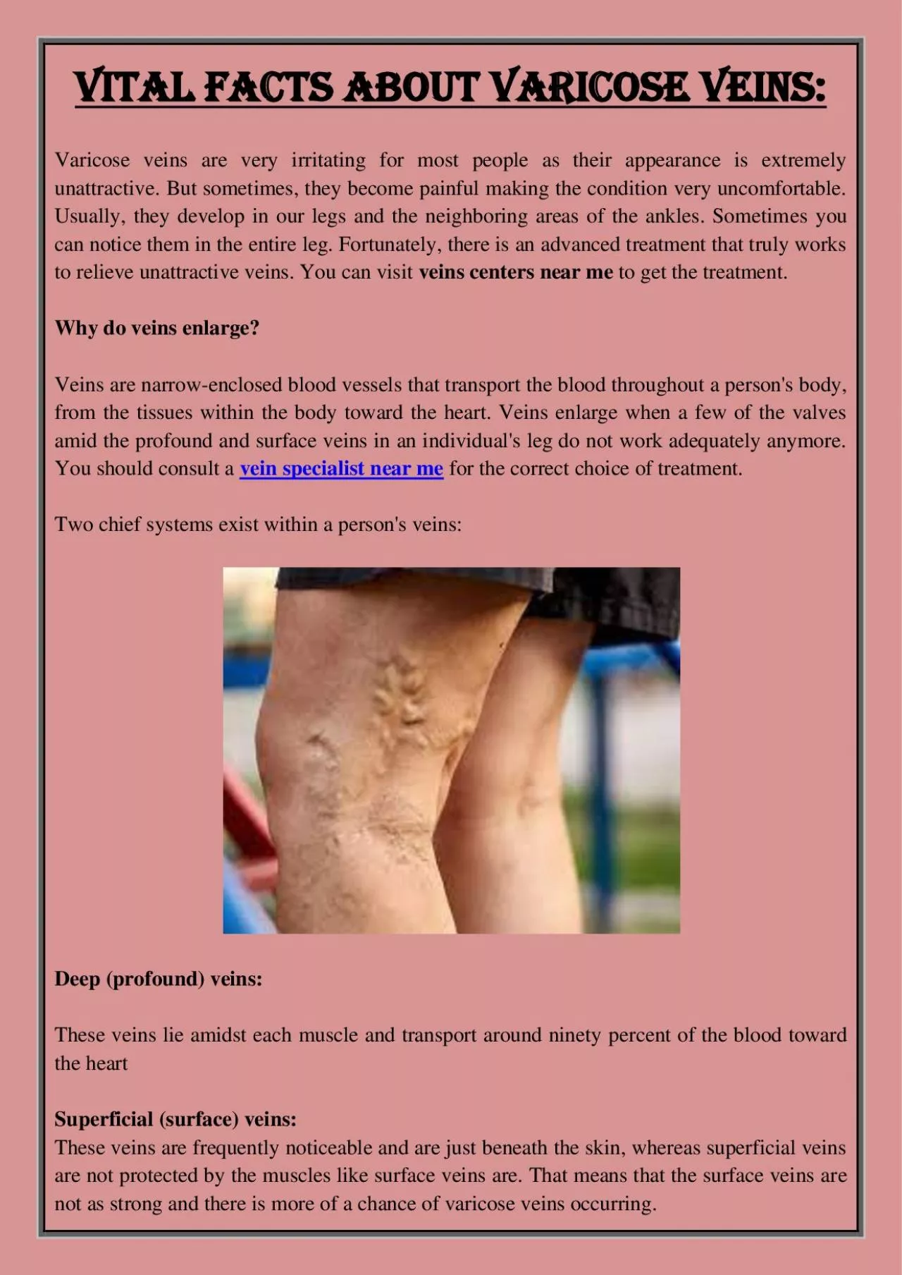 PDF-Vital Facts About Varicose Veins: