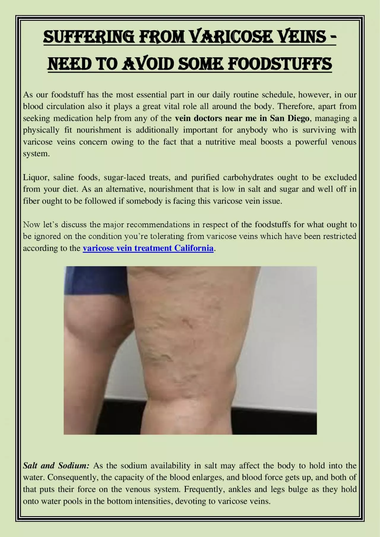 PDF-Suffering From Varicose Veins - Need to Avoid Some Foodstuffs