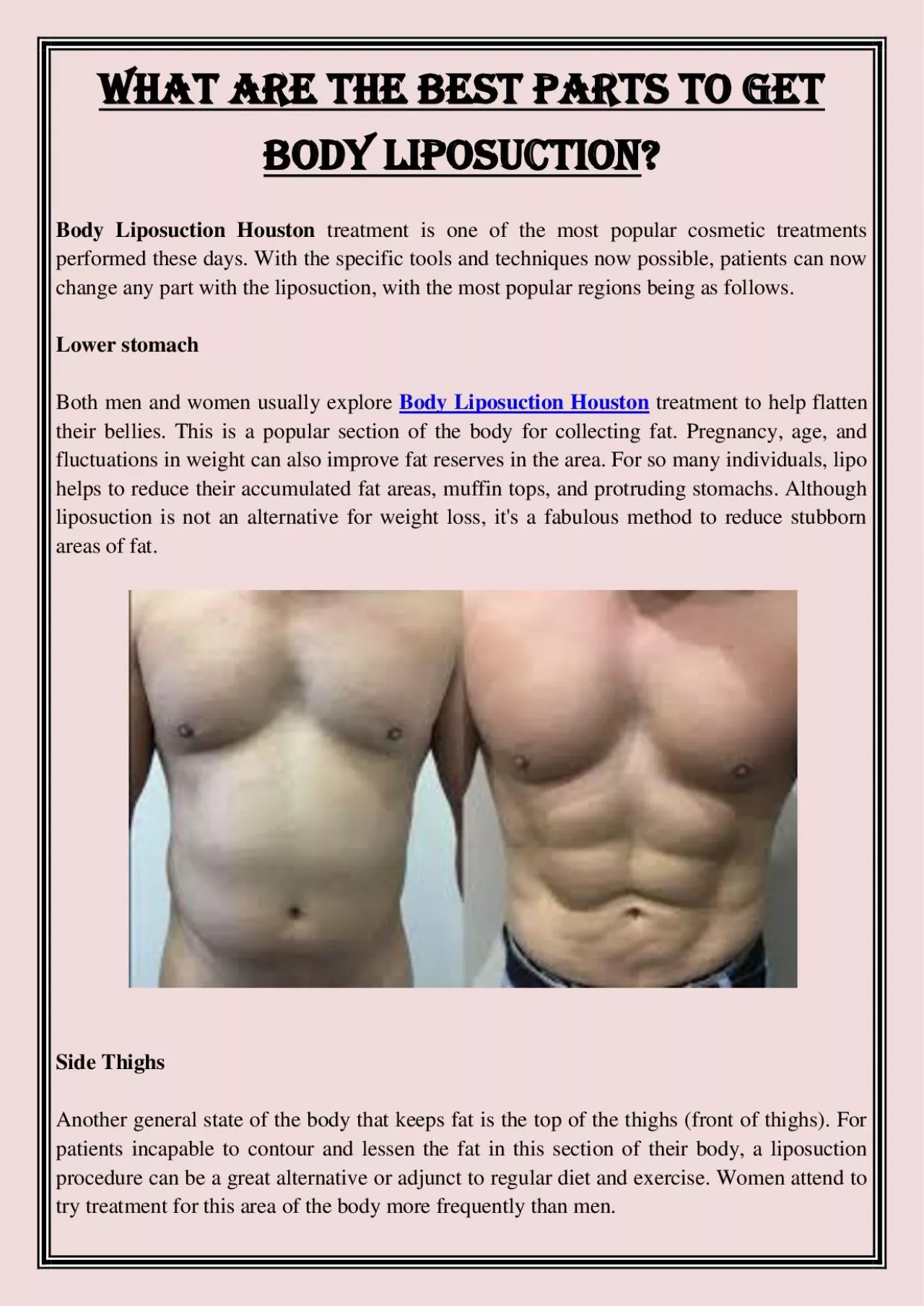 PDF-What are the best parts to get Body Liposuction?