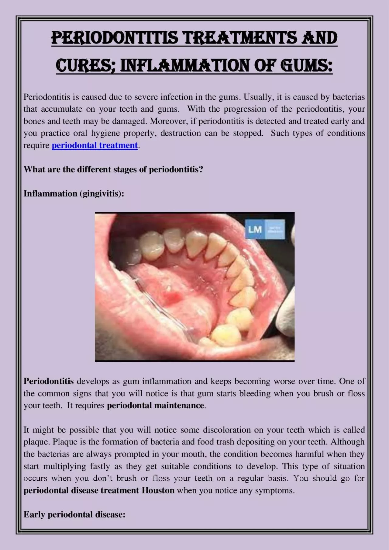 PDF-Periodontitis Treatments And Cures; Inflammation Of Gums: