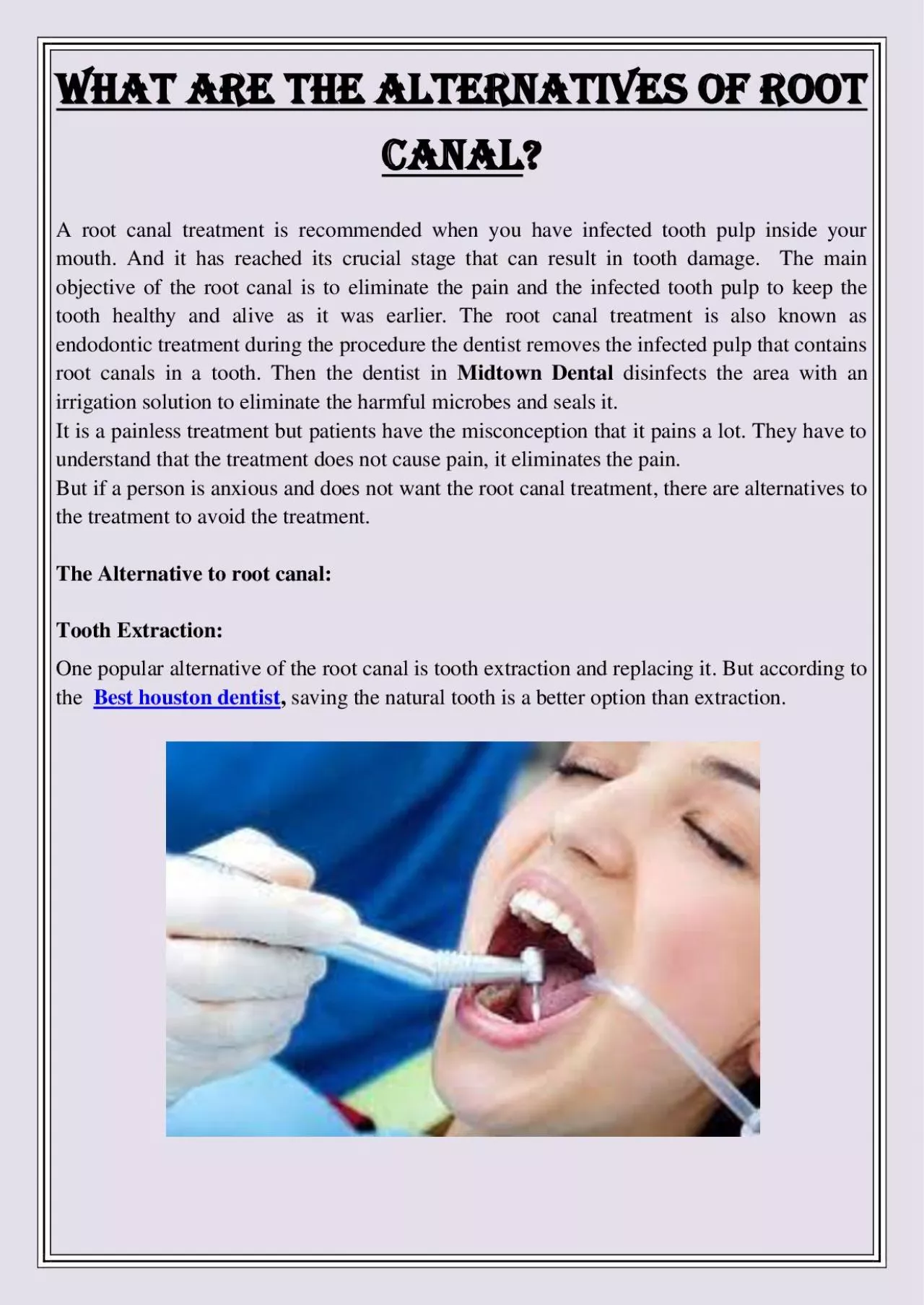 PDF-What are the alternatives of Root Canal?