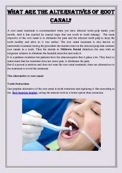 What are the alternatives of Root Canal?