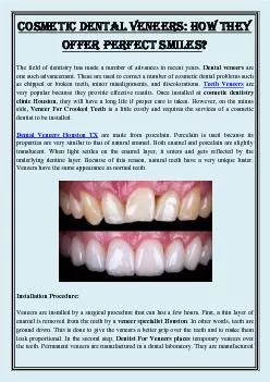 Cosmetic Dental Veneers: How They Offer Perfect Smiles?