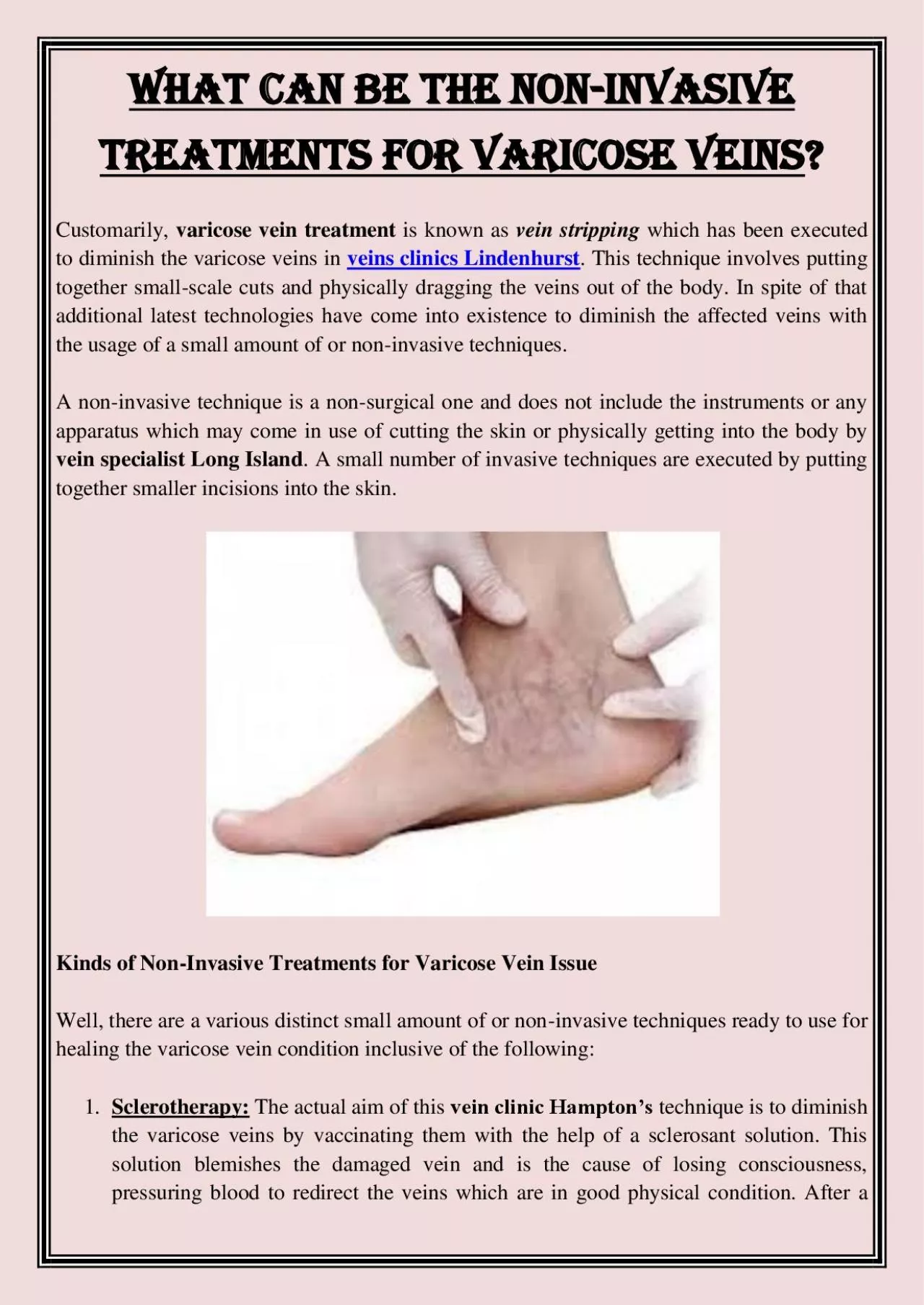 PDF-What Can Be The Non-Invasive Treatments for Varicose Veins?