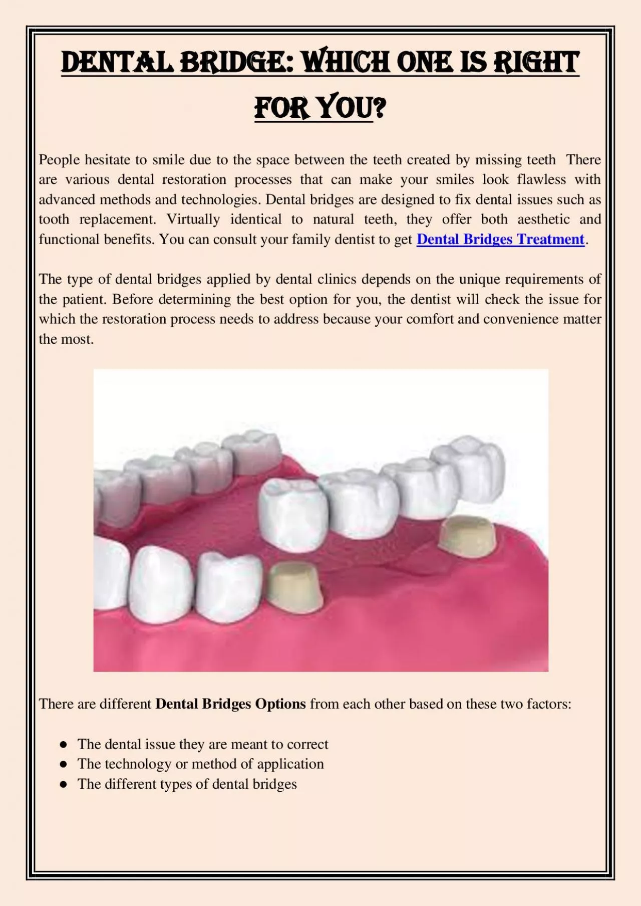 PDF-Dental Bridge: Which One Is Right For You?