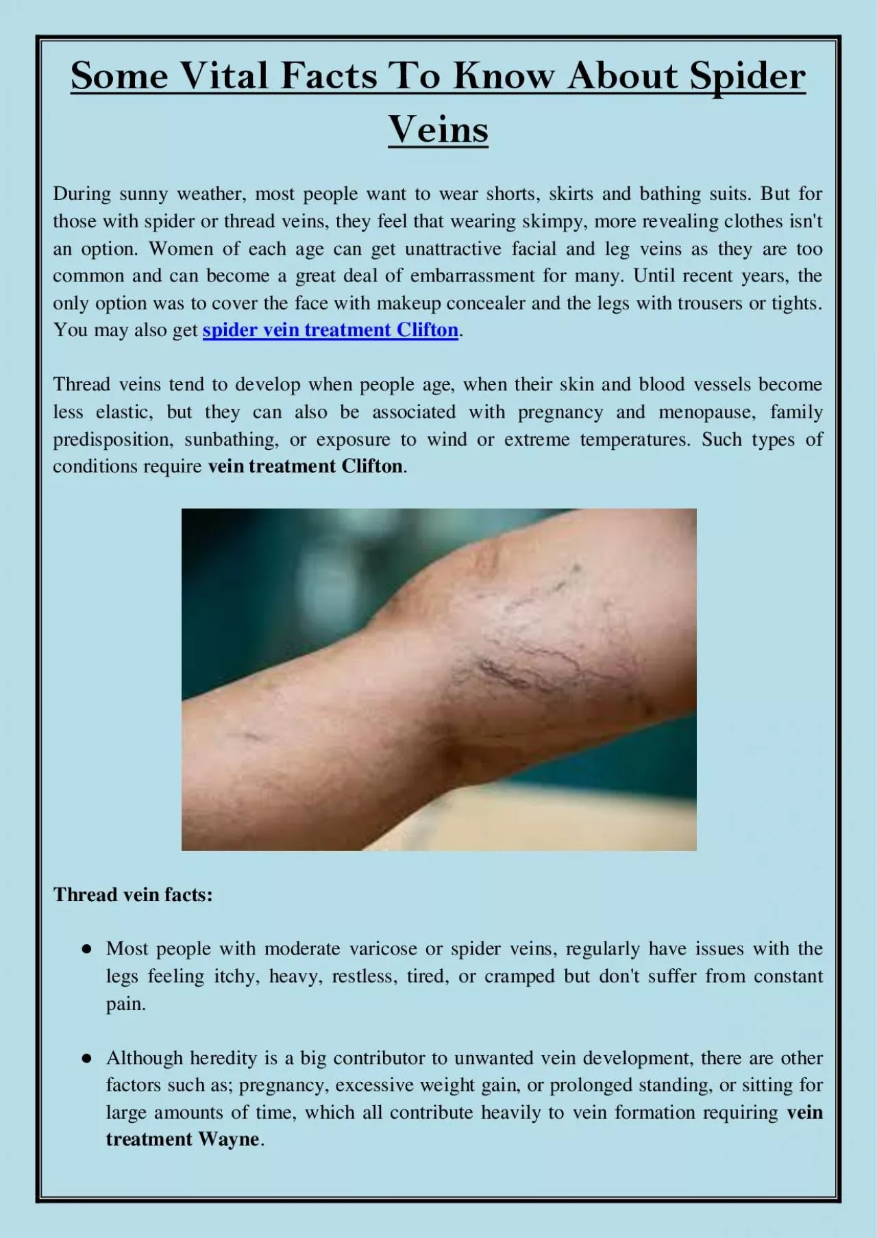 PDF-Some Vital Facts To Know About Spider Veins