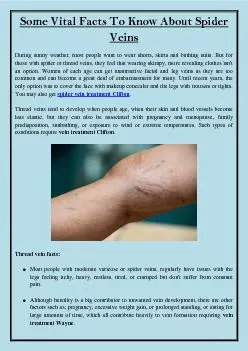 Some Vital Facts To Know About Spider Veins