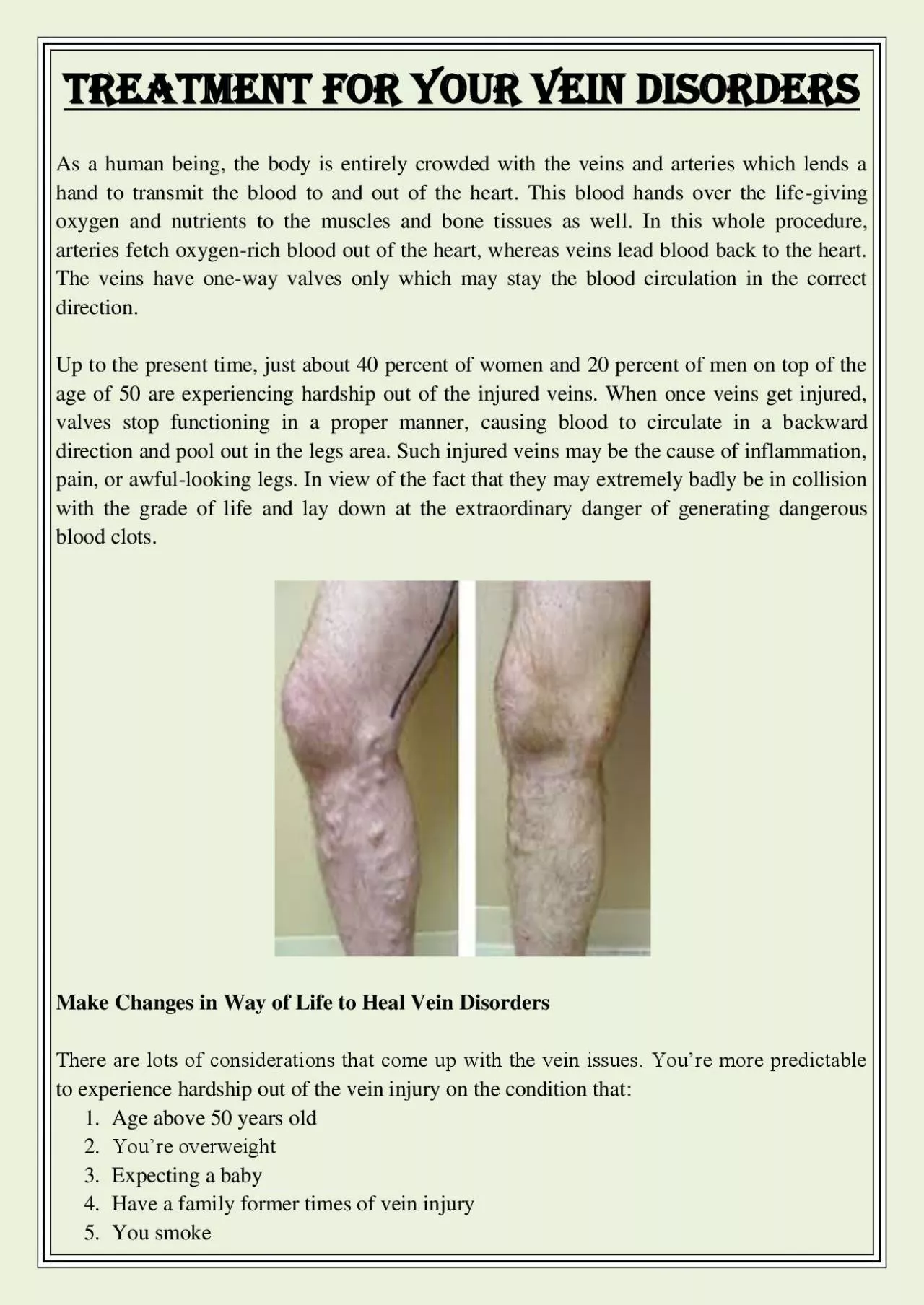 PDF-Treatment for Your Vein Disorders