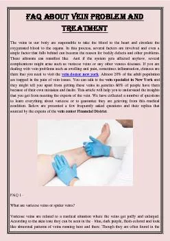 FAQ about vein problem and treatment