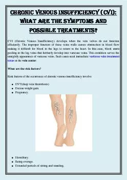 Chronic Venous Insufficiency (CVI): What are the symptoms and possible treatments?