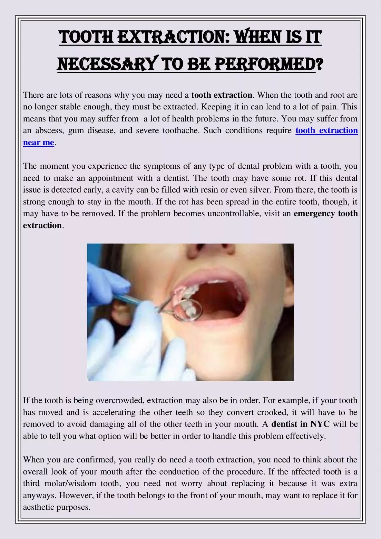 PDF-Tooth Extraction: When is It Necessary to Be Performed?