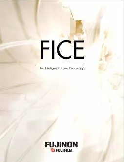 FICE is based on a Spectral Estimation Technology a technology invent