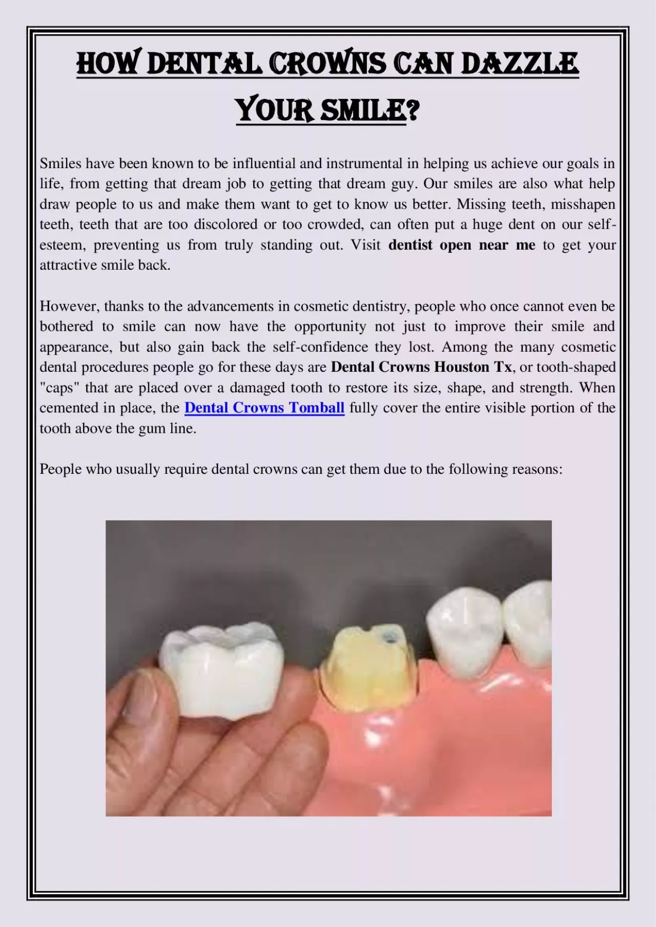 PDF-How Dental Crowns Can Dazzle Your Smile?