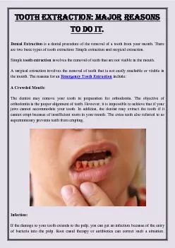 Tooth Extraction: Major Reasons To Do It.