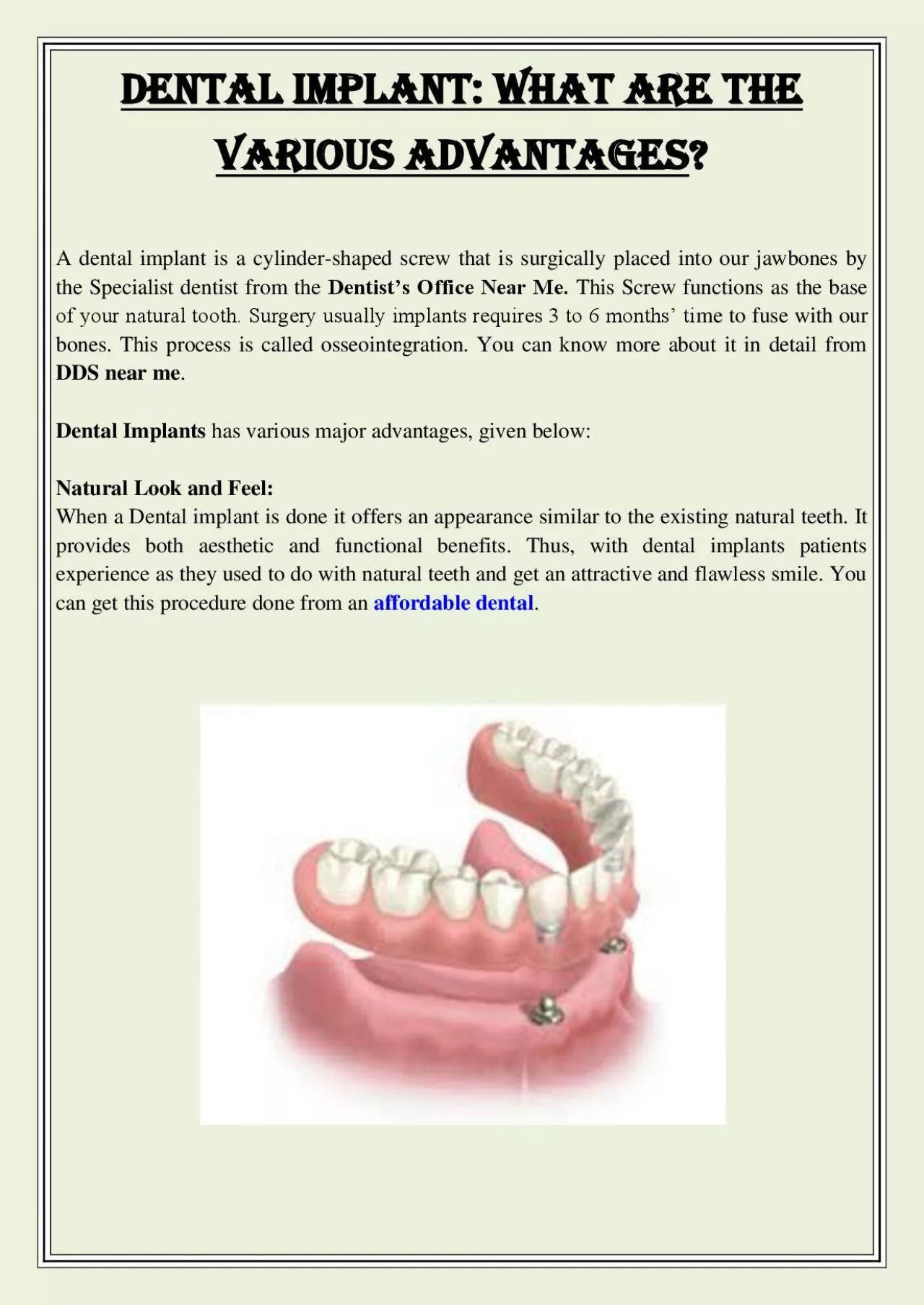 PDF-Dental Implant: What Are The Various Advantages?