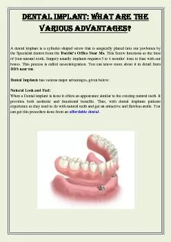Dental Implant: What Are The Various Advantages?