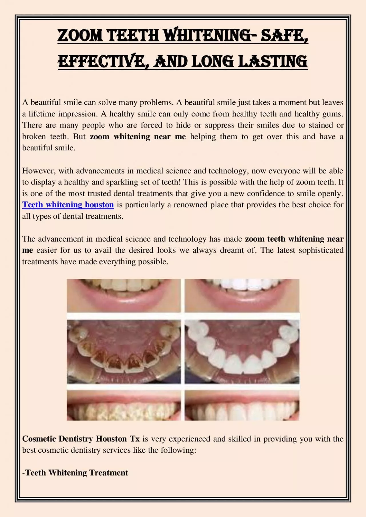 PDF-Zoom Teeth Whitening- Safe, Effective, and Long lasting