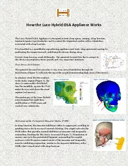 How the Luco Hybrid OSA Appliance Works