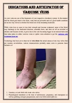 Indications and Anticipation of Varicose Veins