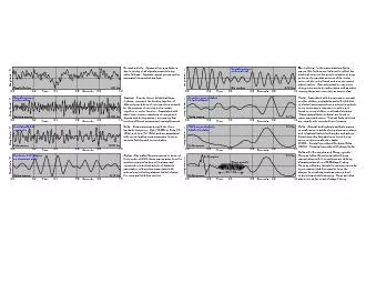 0004060810Amplitude  VAwakeActive120 HzTimeSeconds