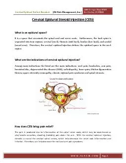 Cervical Epidural Patient Handout