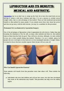 Liposuction And Its Benefits: Medical And Aesthetic.