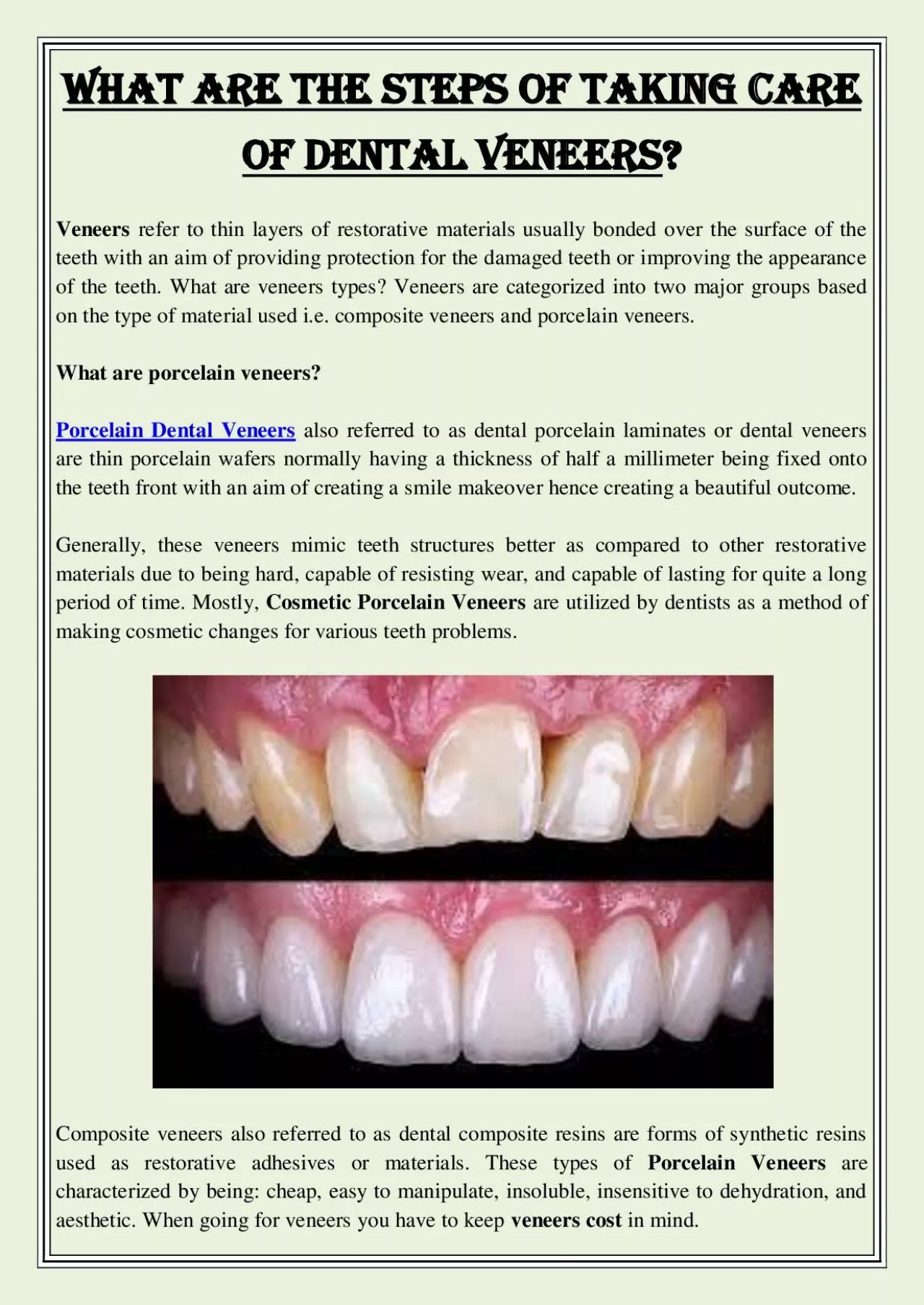 PDF-What are the steps of taking care of Dental Veneers?