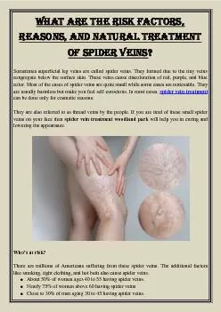 What are the risk factors, reasons, and natural treatment of spider veins?