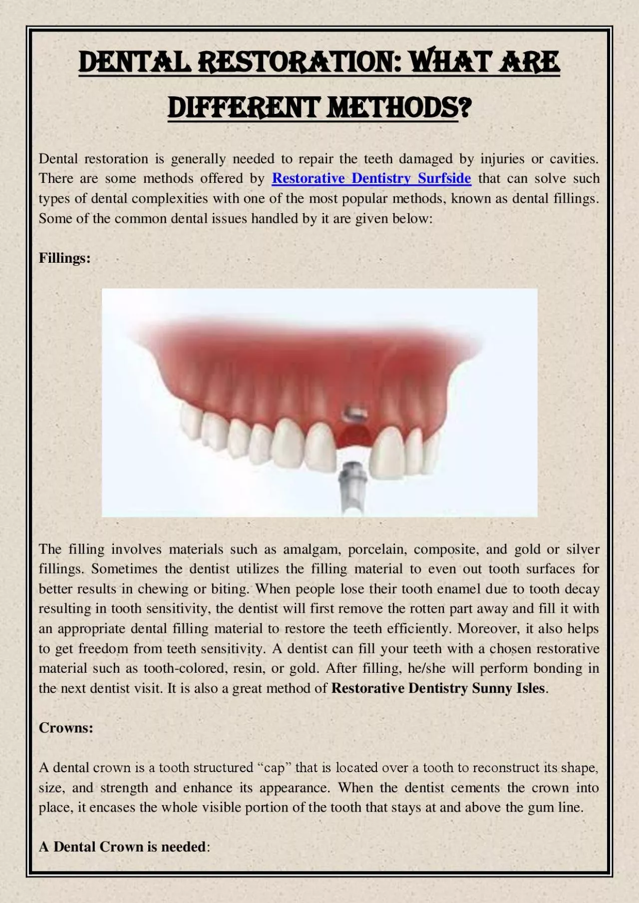 PDF-Dental restoration: What Are Different Methods?