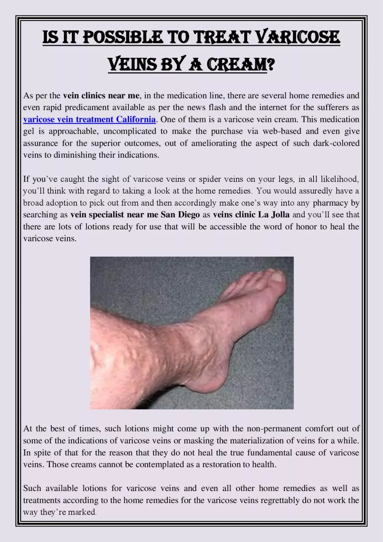 PDF-Is It Possible to Treat Varicose Veins by a Cream?