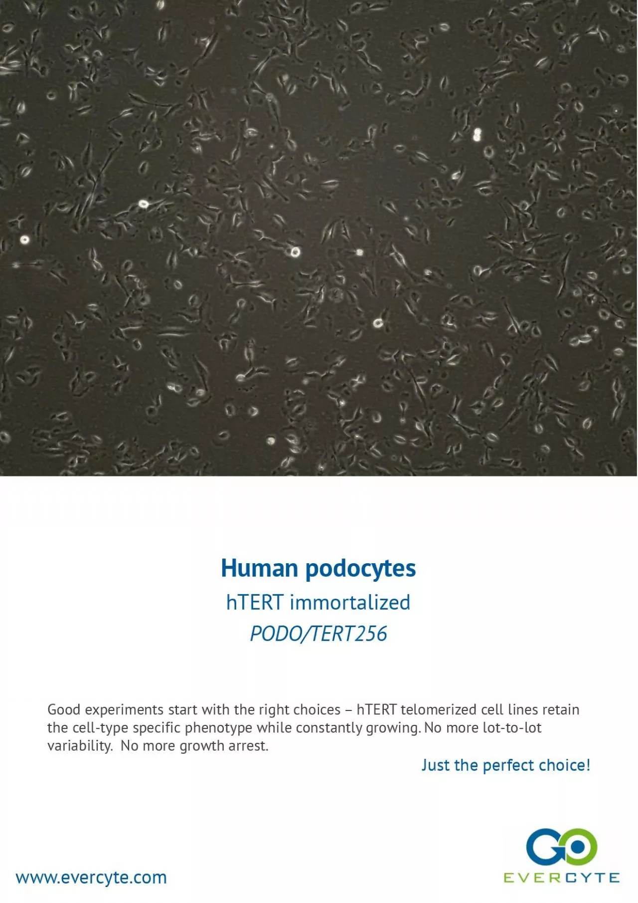 PDF-Human podocytes