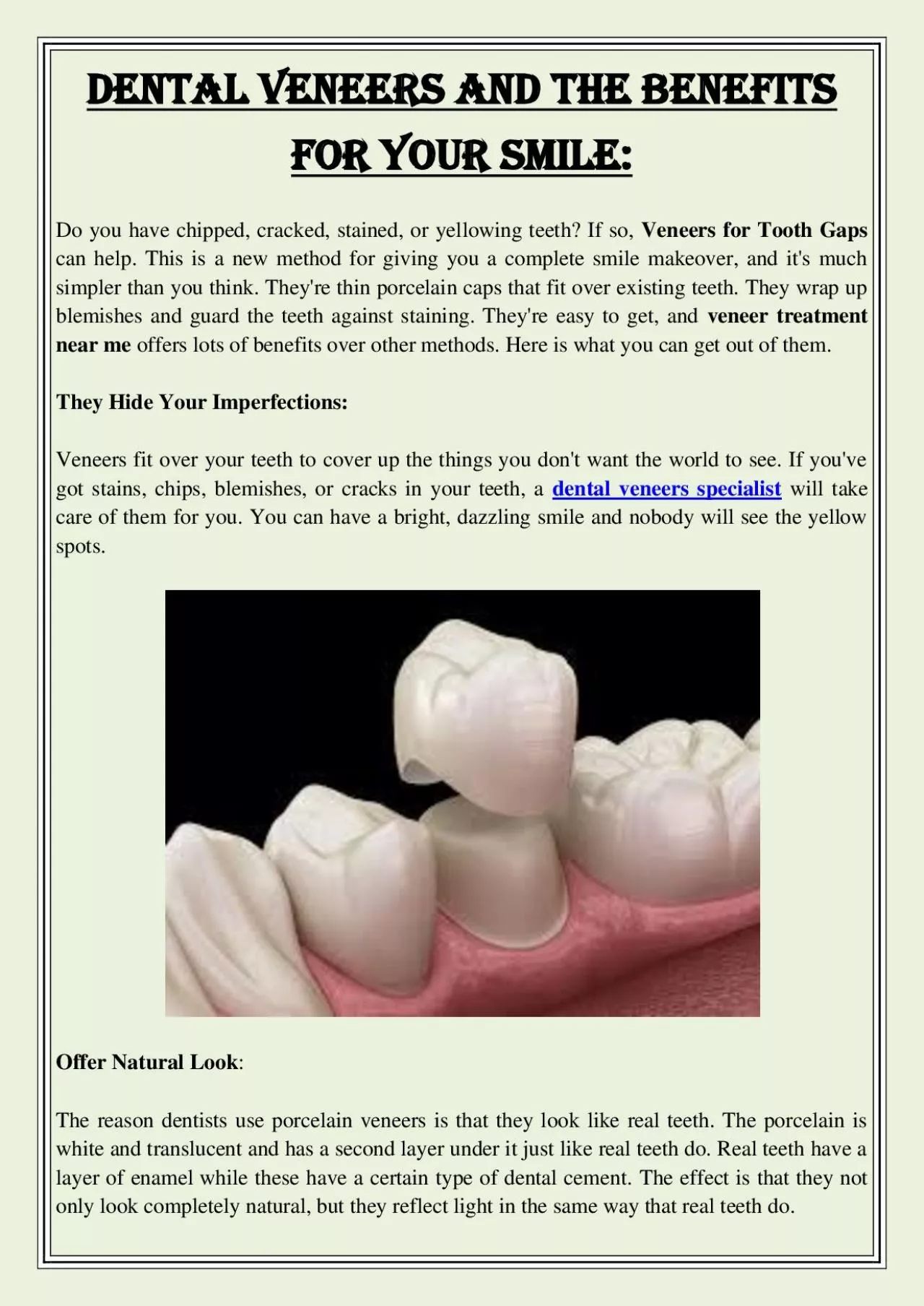 PDF-Dental Veneers And The Benefits For Your Smile: