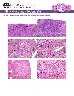 PDF-Basophilic Eosinophilic Clear cell Mixed Focus