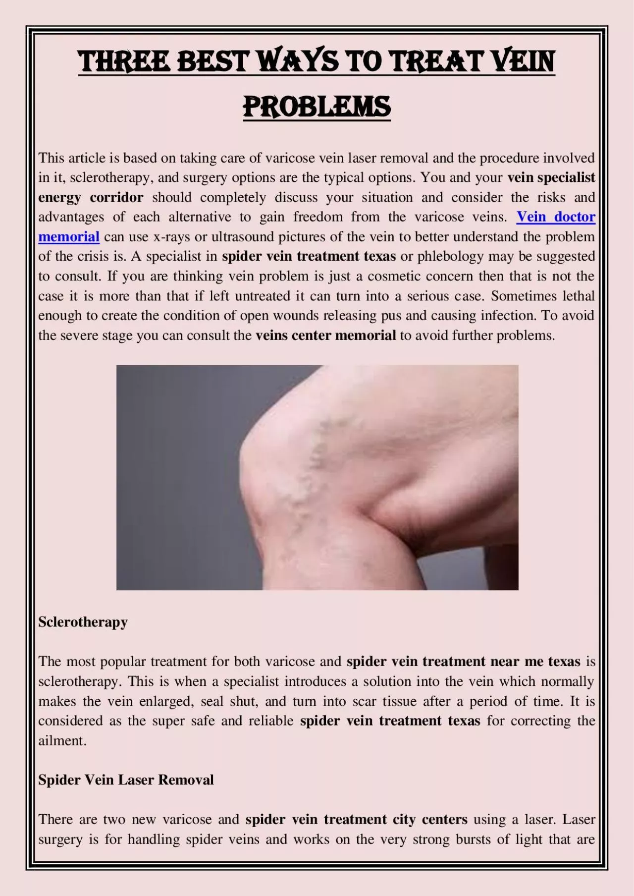 PDF-Three Best Ways To Treat vein problems