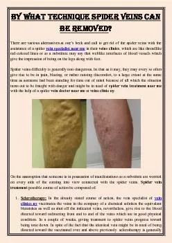 By What Technique Spider Veins Can Be Removed?