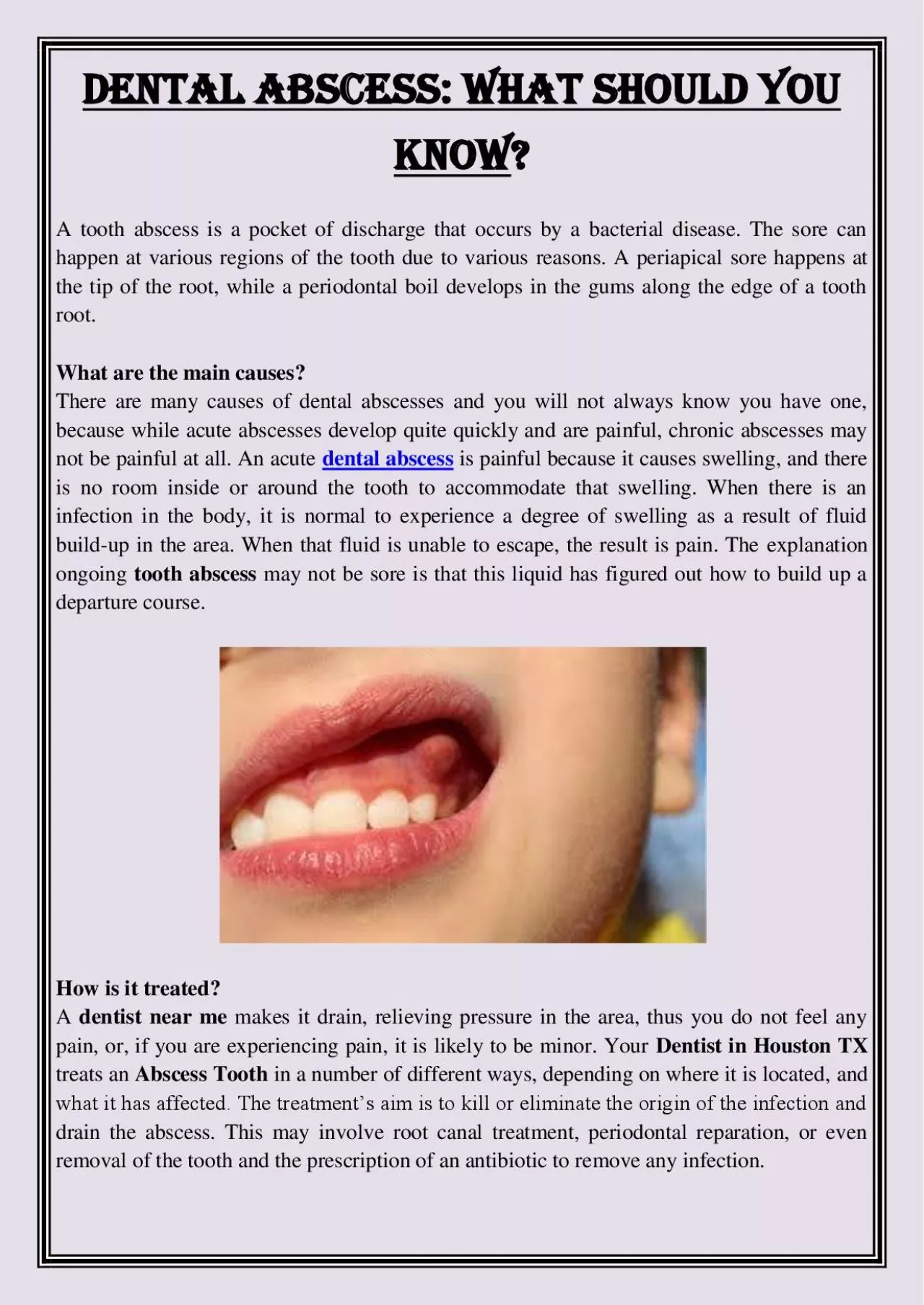 PDF-Dental Abscess: What should you know?