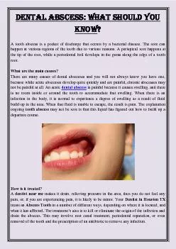 Dental Abscess: What should you know?