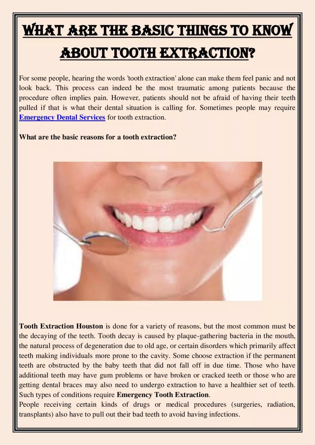 PDF-What Are The Basic Things To Know About Tooth Extraction?