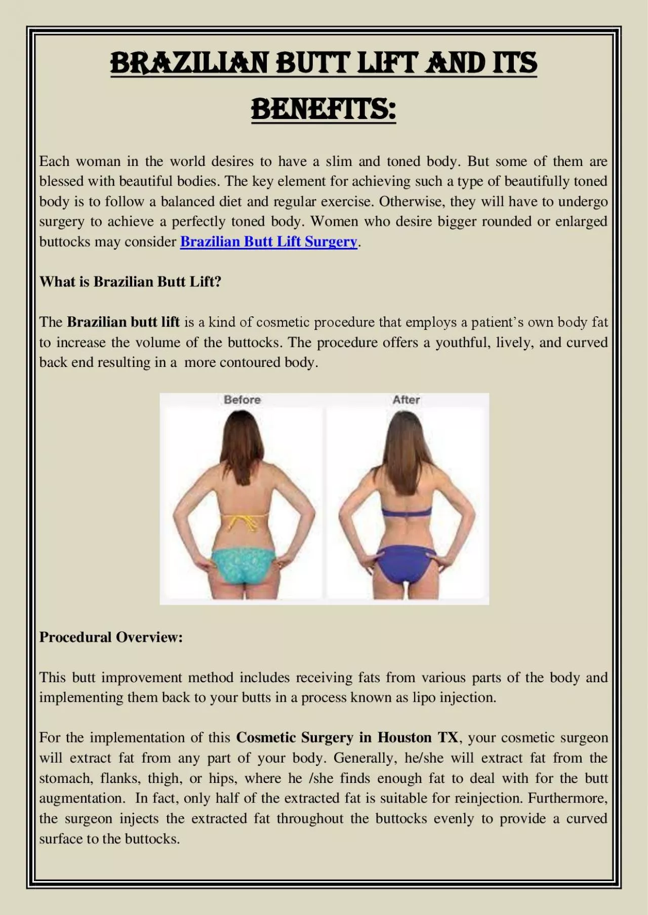 PDF-Brazilian Butt Lift and Its Benefits: